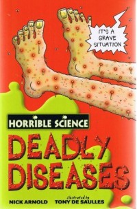 Horrible Science: 4 book collection: Ugly Bugs, Nasty Nature, Disgusting Digestion and Deadly Diseases rrp £19.96